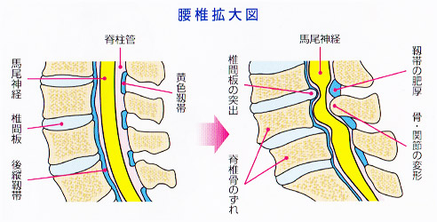 腰椎拡大図